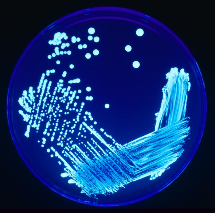 Piastra piena di formazioni di legionella.